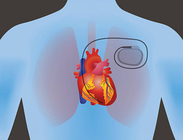 Cardiac Pacemaker Market