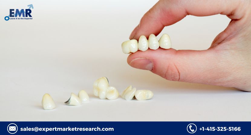 Global Dental Crowns and Bridges Market to be Driven by the Rapid Technological Advancements in the Forecast Period of 2021-2026