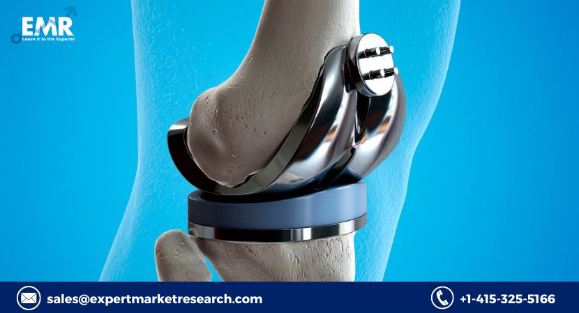 Medical Implant Market